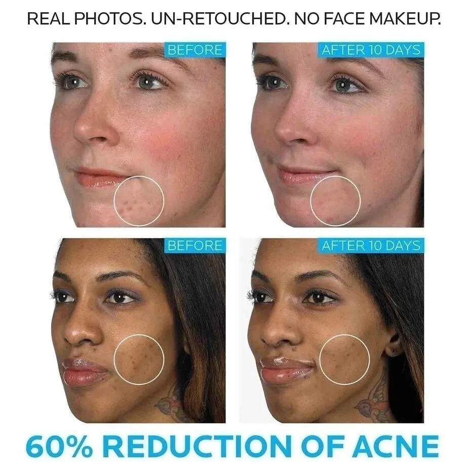La Roche Posay Effaclar Purifying Foaming Gel Cleanser